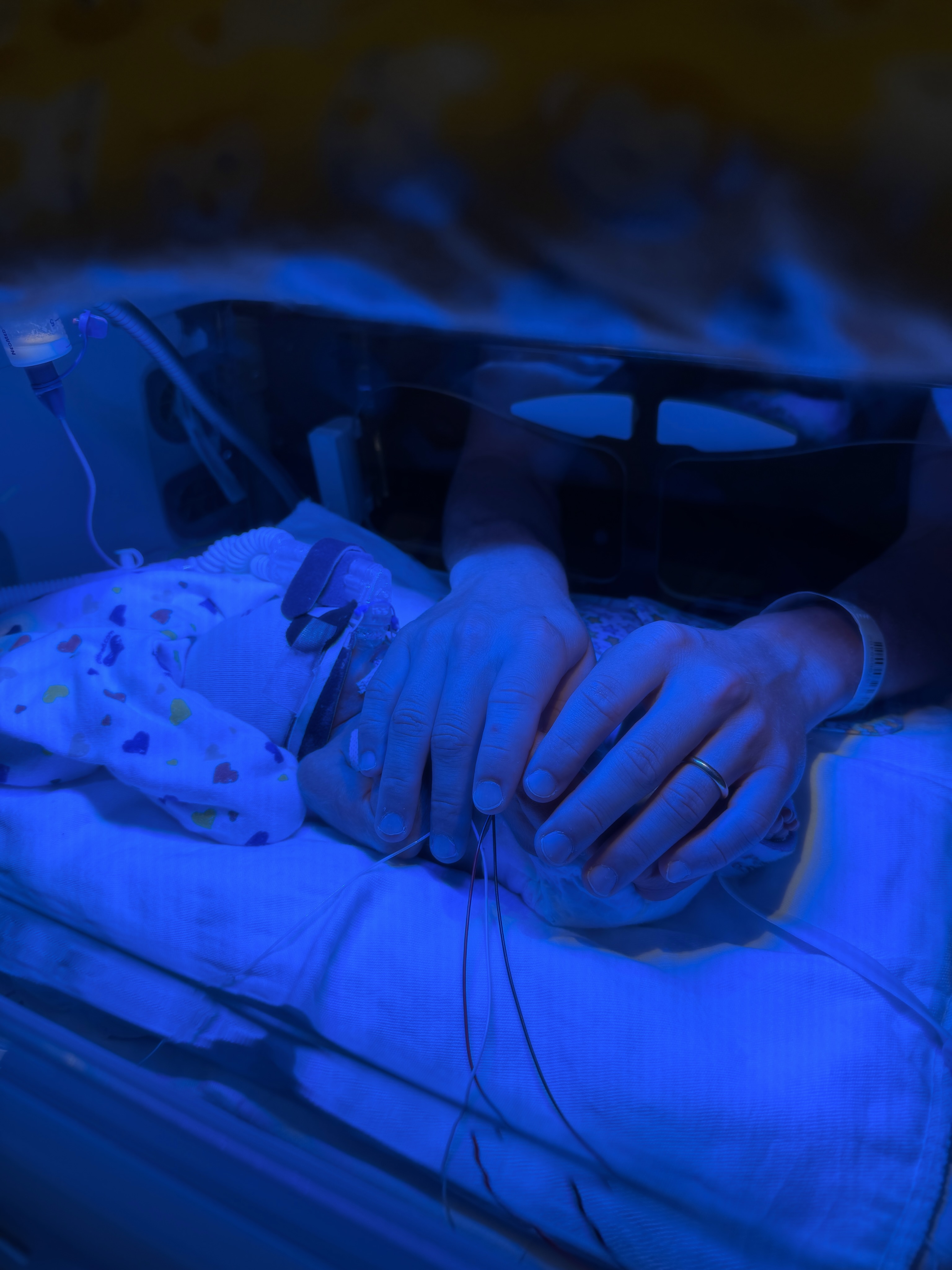 A tiny Bond lies inside a hospital bassinet under blue light as two adult hands gently rest over him during his NICU stay. | Source: Instagram/elliottpbure